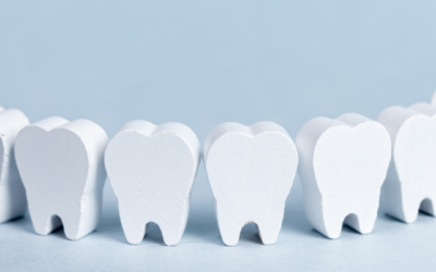 So läuft die Zahnimplantation ab – in 5 Schritten zum neuen Lebensgefühl